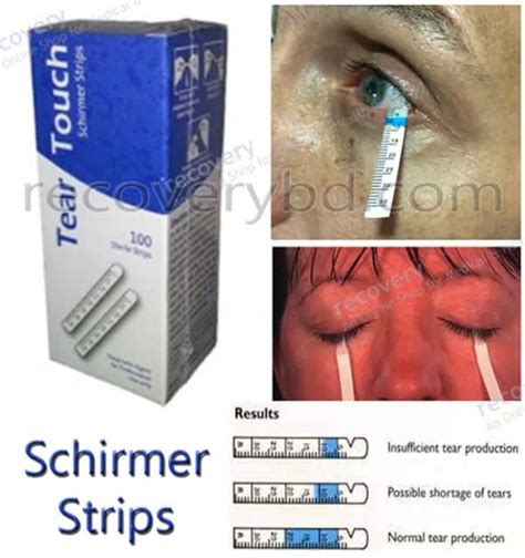 shirmer tear test and fluorescein stain and tonometery|schirmer tear test strips.